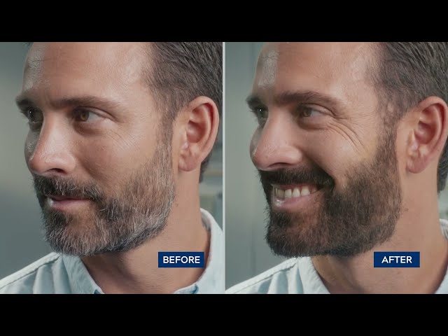 Beard Hair Dye Before and After